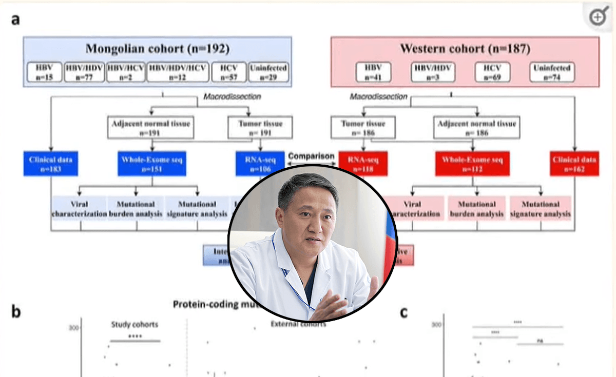 SOS: Утаанаас үүдэлтэй элэгний хорт хавдрын өвчлөл Монголыг бүрхсэнийг гаднын эрдэмтдийн судалгаа нотоллоо